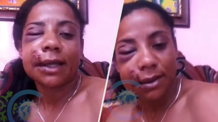 Haitiano Le Da En La Cara A Una Mujer Con Un Tanque De Gas “porque Le Dio La Gana” | Lo Explica Todo 