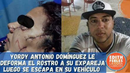 Yordy Antonio Domínguez Le Deforma El Rostro A Su Expareja Luego Se Escapa En Su Vehículo