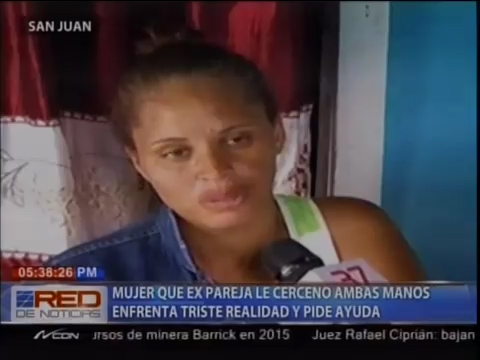 Mujer Que Ex Pareja Le Cerceno Ambas Manos Enfrenta Triste Realidad Y Pide Ayuda #Video